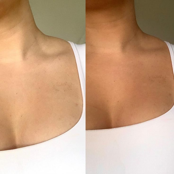 Mousse autobronzante SUNEA