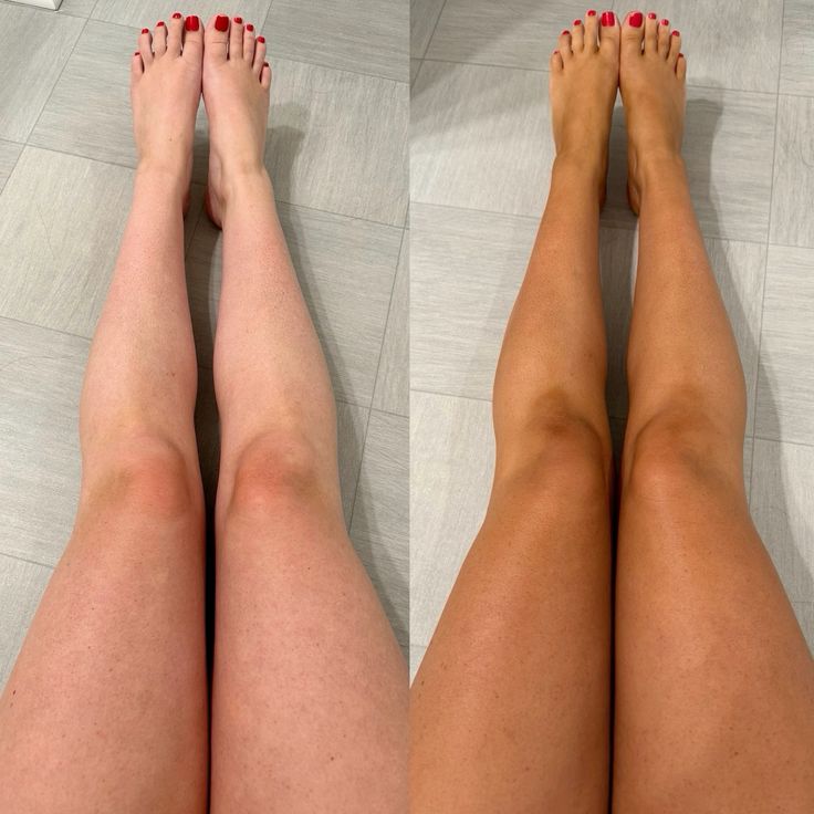 Mousse autobronzante SUNEA