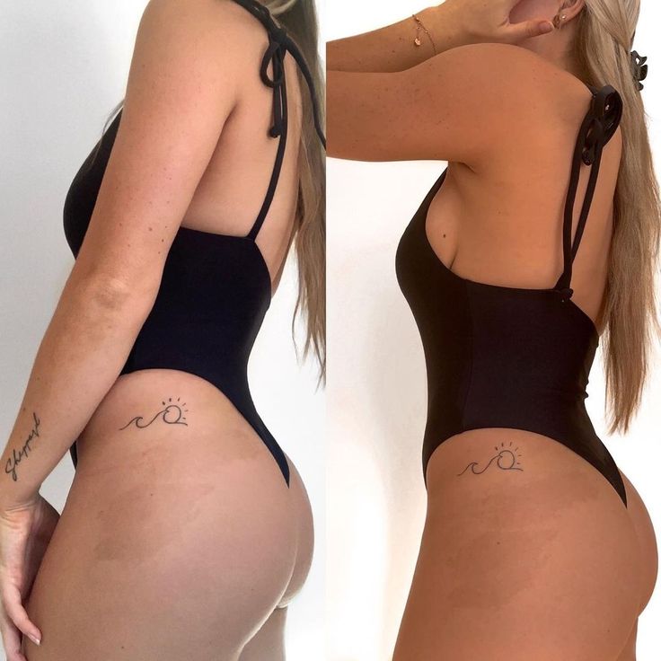 Mousse autobronzante SUNEA